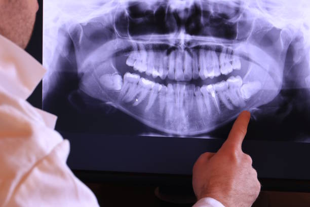 Best Broken or Chipped Tooth Repair in Marysville, PA